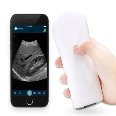 Wireless Ultrasound  Probe Android